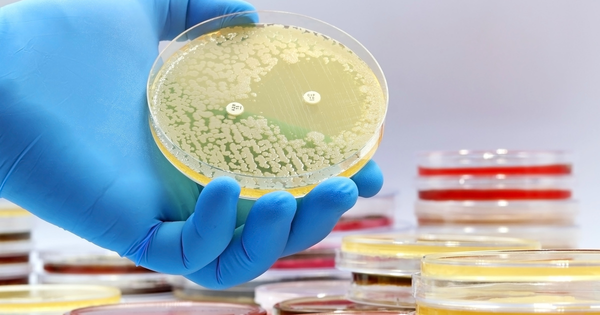 Troisième plan écoantibio : l'Anses identifie des couples bactéries-antibiotiques prioritaires